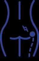 Sciatica