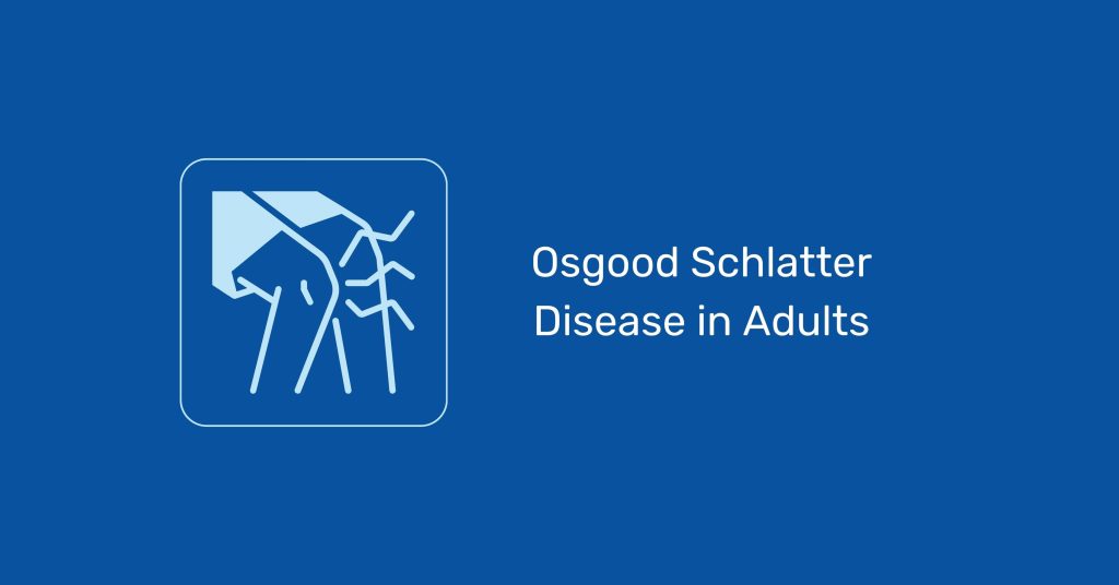 Osgood Schlatter Disease in Adults: How to Find Relief Faster in 2023