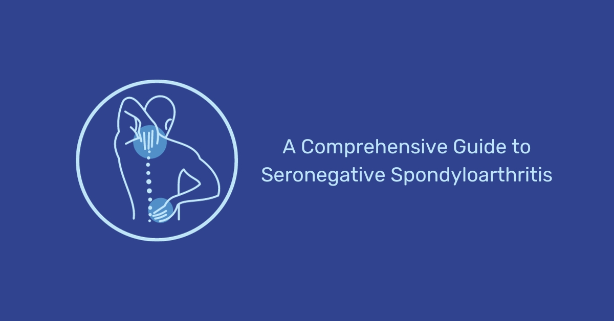 Understanding treatment options for seronegative spondyloarthritis